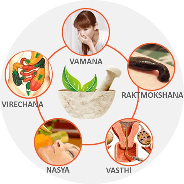 Panchakarma therapy at an Ayurvedic clinic in Kandivali East